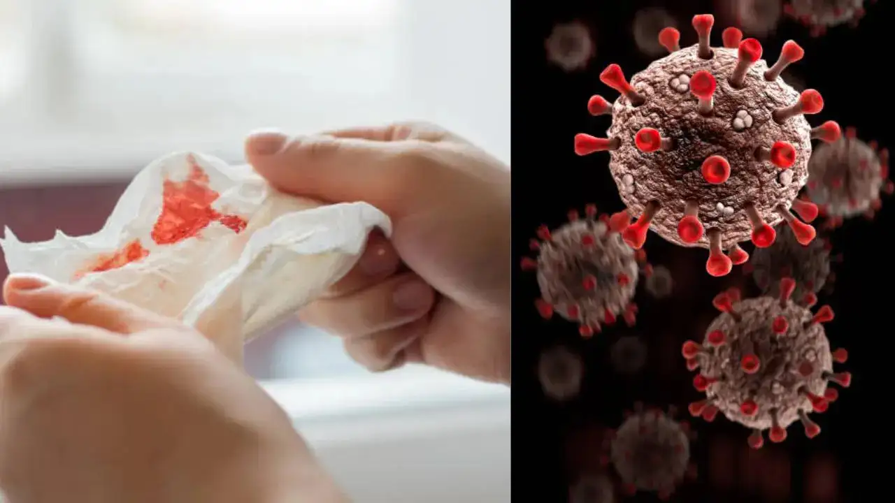 COVID-19-Like Mystery Virus Outbreak in Russia Leave Victims with High Fever, Bloody Cough; Cause Not Known