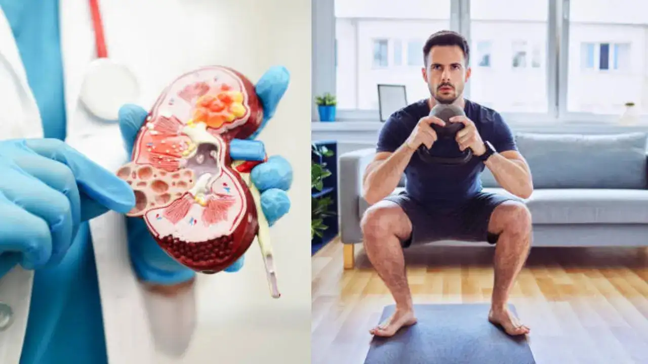 Man Suffers Kidney Damage After Squat Challenge Goes Wrong; Here's How To Do It Safely