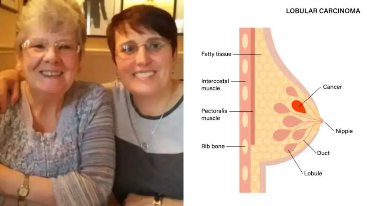 Woman Diagnosed With Breast Cancer Five Days After Her Mother Died of the Same Disease, Is It Genetic?