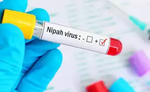 Kerala's Malappuram District Reports Nipah Virus In Bat Samples; Tips To Keep Yourself Safe