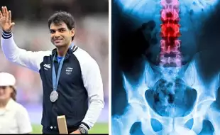 How Did Groin Injury Impact Neeraj Chopra's Performance in the Paris Olympics? All About Inguinal Hernia He Is Suffering From