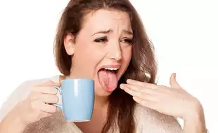 Burnt Your Tongue After Having Hot Food? Home Remedies That May Help Alleviate Pain