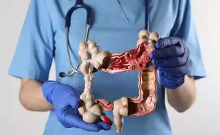 Study Says Diet Can Be A Risk Factor For Colon Cancer In Young Adults
