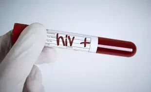 Fiji Reports 552 HIV Cases In First Six Months Of The Year; Tips To Prevent The Spread Of The Infectious Disease