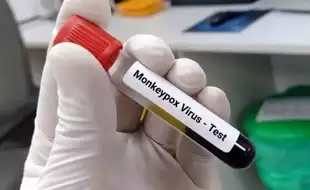 Pakistan Reports Three Mpox Cases; Check Symptoms And Preventive Measures Of The Viral Infection