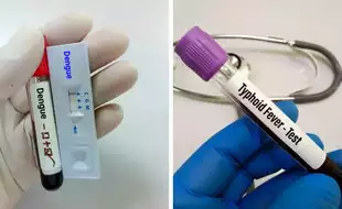 How To Detect And Prevent Dengue And Typhoid Co-Infection During Monsoon?