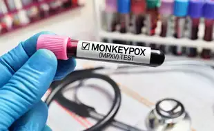 New Deadly Mpox Variant Is 'Very Likely' In The UK: Expert