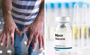 Could The New Mpox Threat Cause Significant Harm In The US? Experts Call For Increased Vigilance