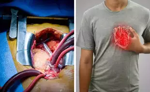 What Is The Difference Between A Bypass And An Open Heart Surgery?  Know Their Purpose And Dangerous Side Effects