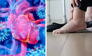 Myocarditis - A Hidden Condition That Can Be A Sign Of Swelling On Your Ankles, Legs, Feet; Are You At Risk?