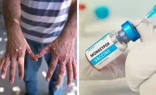 Mpox Outbreak: Vaccines May Not Protect Against Deadly New Viral Strain Clade 1B Spreading Rapidly, Say Experts