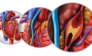 Bypass Heart Procedure Offers Hope For Elderly With Co-Morbidities; Know How It Treated A 90-Year-old With Prostate Cancer