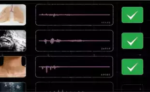 Google Unveils AI That Can Spot Tuberculosis Just By Listening To Your Cough and Breathing
