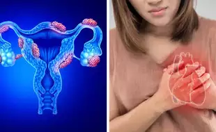 Endometriosis Linked To Higher Heart Risks For Women, Says Study; Know Ways To Mitigate The Risk
