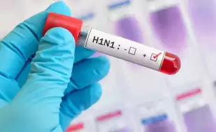 Indore Reports First Swine Flu Death, Measures To Keep Yourself Safe