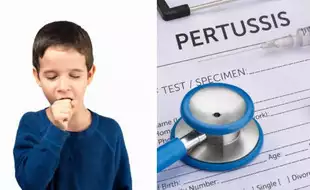 Whooping Cough Wave Is The Worst In Almost A Decade Among US Children, Says CDC