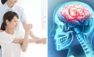 Can You Treat Neurological Conditions With Physiotherapy? Experts Say, Yes; Know How
