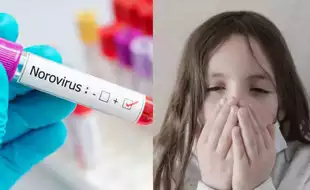 Norovirus Outbreak In US: Experts Lists Measures To Protect Kids