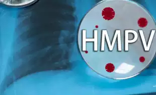 FAQs On HMPV Virus: Should You Be Concerned? All Your Questions Answered
