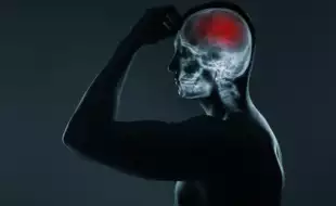 Could You Spot the Silent Stroke Risk During Pregnancy? What to Know About CVST