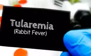 CDC Reports Major Spike In Human Cases Of Rabbit Fever In The Last Decade