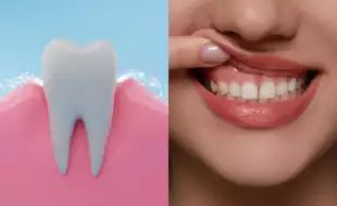 Do You Massage Your Gums Before Going To Bed? How to Decide If You Should