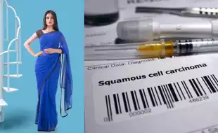 Is Petticoat Cancer Real? Know Ways To Prevent the Deadly Squamous Cell Carcinoma Caused by Tight Waist Cords
