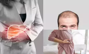 5 Unmissable Signs of Fatty Liver You Can Check Easily At Home, According to Top Liver Specialist