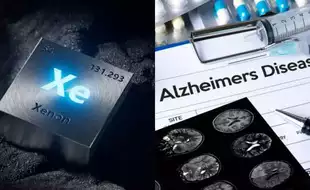 THIS Rare Gas Could Treat Alzheimer's Disease, A Breakthrough Study Finds