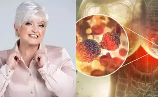 Red Flag Signs of Breast Cancer You Must Not Ignore After Pop Star Linda Nolan Died Battling the Disease for 20 Years