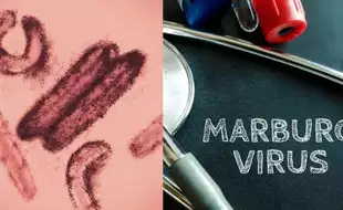 WHO Fears Confirmed As Sample From Remote Tanzanian Region Tests Positive For Marburg Virus