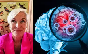 What Is Glioblastoma, An Aggressive Brain Cancer Women's Rights Activist Cecile Richards Died of? Know Prominent Symptoms