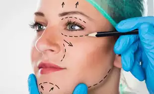 Considering A Facelift? 6 Things To Know Before You Decide
