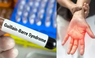 Avoid Eating Out: AIIMS Neurologist Identifies Foods That Are Triggering Pune's Guillain-Barre Syndrome