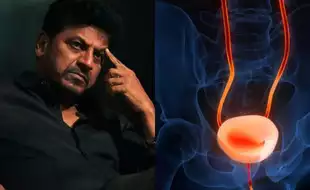 What Is Bladder Cancer That Kannada Actor Shiva Rajkumar Had? Know the First Signs of This Silent Threat
