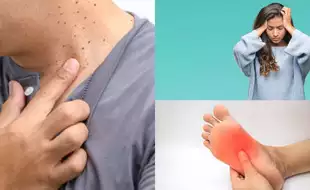 5 Sneaky Signs You May Have Metabolic Syndrome That Increase The Risk of Life-threatening Health Conditions