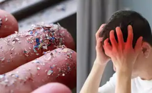 Microplastics May Disrupt Blood Flow To The Brain: Study
