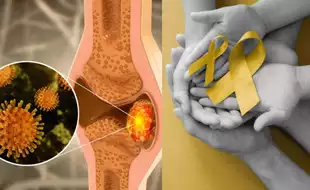 World Cancer Day 2025: Is Your Bone Pain A Warning Sign For Cancer? Expert Answers