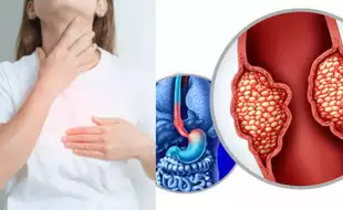 Why is Esophageal Cancer Rate in the UK Higher Than Most of Europe? 4 Signs Your Sore Throat Needs Immediate Attention