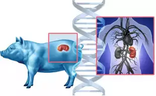 FDA Approves Clinical Trials for Pig Kidney Transplants in Humans