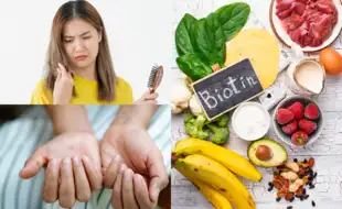Biotin to the Rescue: Eat Your Way to Stronger Hair and Nails