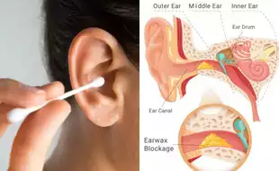 Beware! THIS Common Bathroom Item Can Trigger Tinnitus; How to Safely Clean Your Ears?