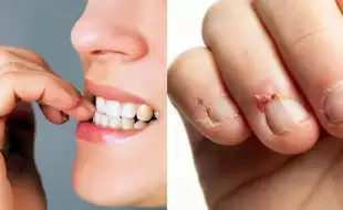 Inflammation, Infection, And Other Gross Things That Happen When You Bite Your Nails