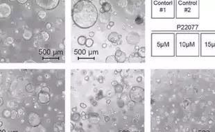 Cancer Breakthrough: Scientists Find A `Switch' That Can Reverse The Dreaded Disease In Cells