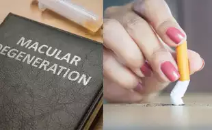 Attention! Smoking Causes Vision Loss and Blindness; Can Macular Degeneration Be Prevented?