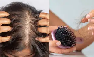 Your Hairfall Might Not Be Normal—These Signs Indicate A Hormonal Disaster!