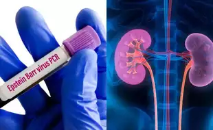 Could Epstein-Barr Virus Be The Silent Trigger For Cancer After Kidney Transplant?