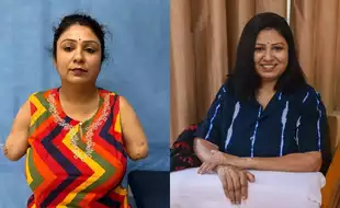 76-Year-Old Donor Saves 5 Lives In 12 Hours With Double-Hand, Kidney, Lung And Cornea Transplants!