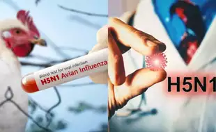 Bird Flu Outbreak: Wyoming Confirms First-Ever Case — Should You Be Concerned?