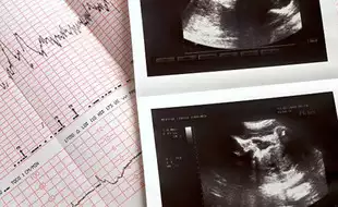 Unborn Baby Receives First-Ever Treatment For Motor Neuron Disease
